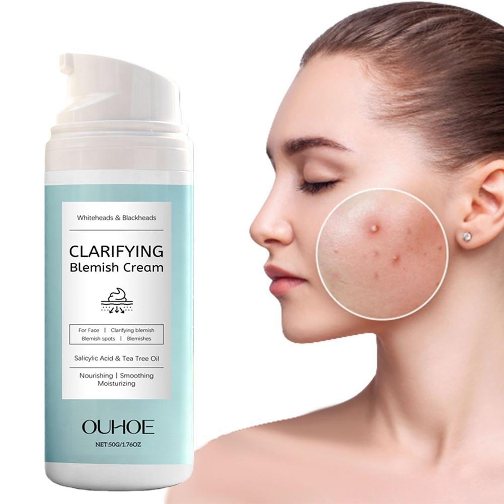 Azelaic Acid Cream - ครีมบำรุงผิวหน้าด้วยกรดซาลิไซลิก สำหรับผิวเป็นสิวง่าย ควบคุมความมัน ปลอบประโลมผิว เนื้อบางเบา ไม่เหนียวเหนอะหนะ