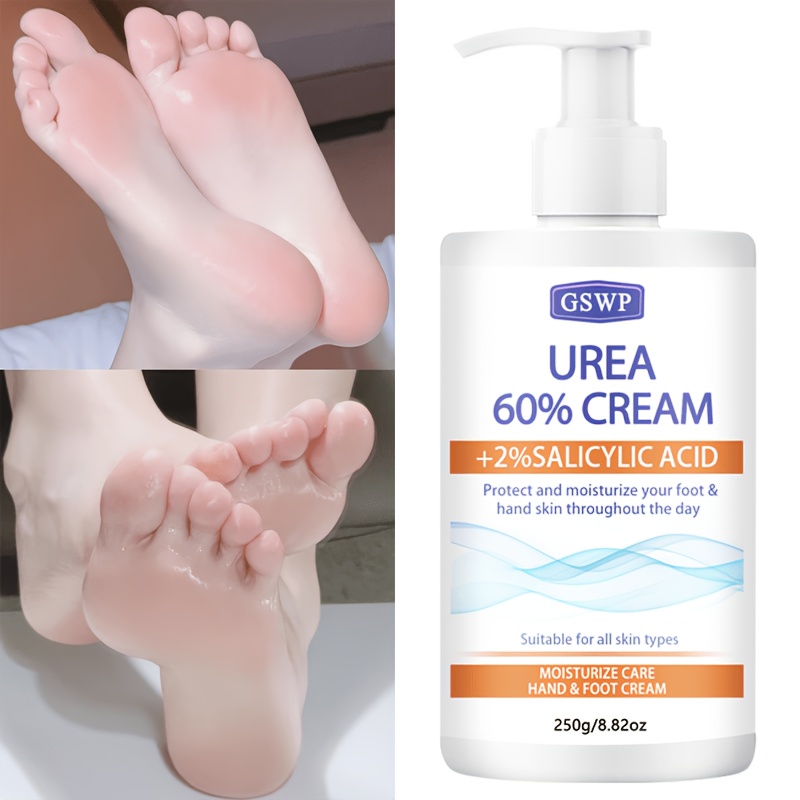 Azelaic Acid Cream - GSWP 60% ยูเรีย มอยส์เจอร์ไรซิ่ง แฮนด์ แอนด์