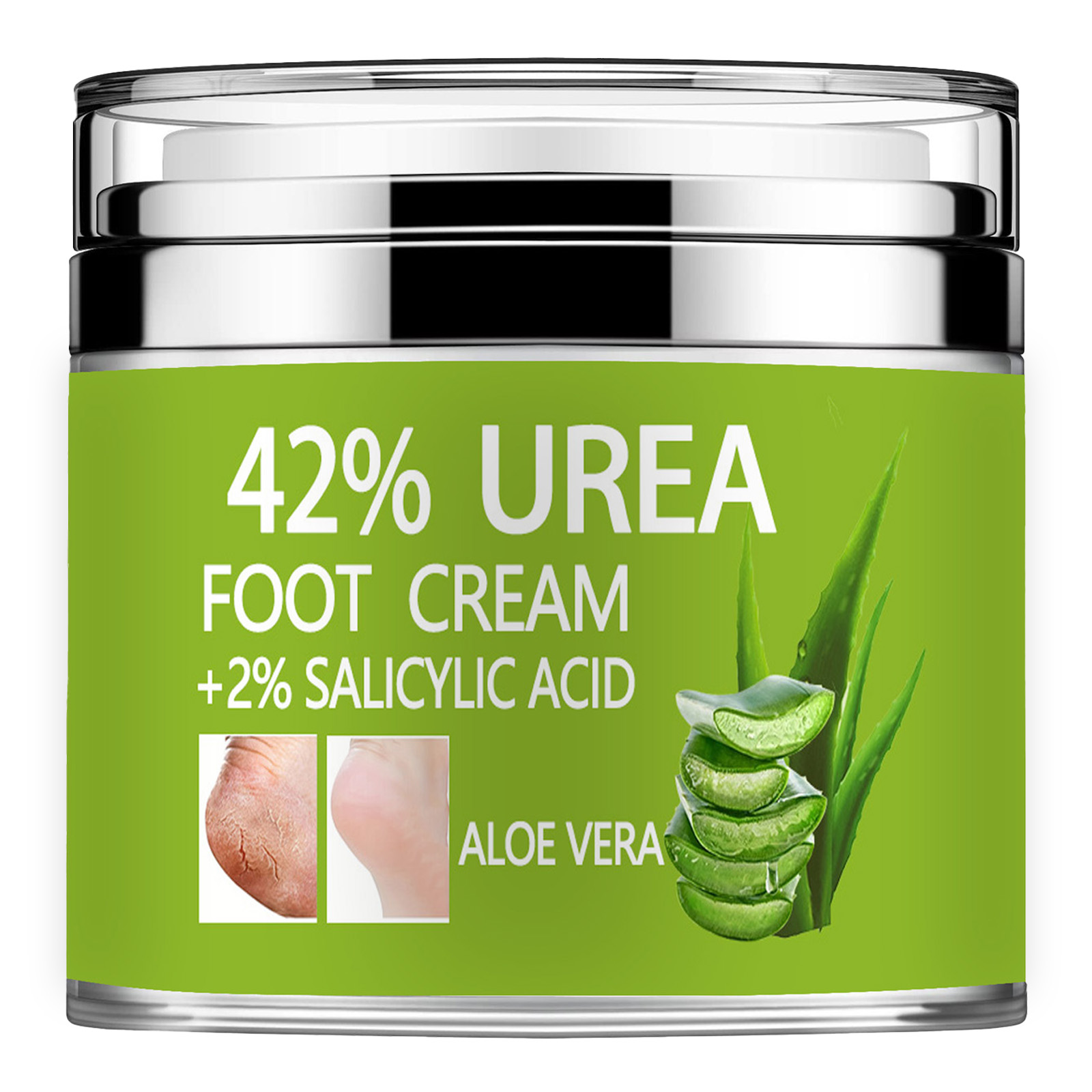 Azelaic Acid Cream - ยูเรียครีม 42% Plus Salicylic Acid 2%