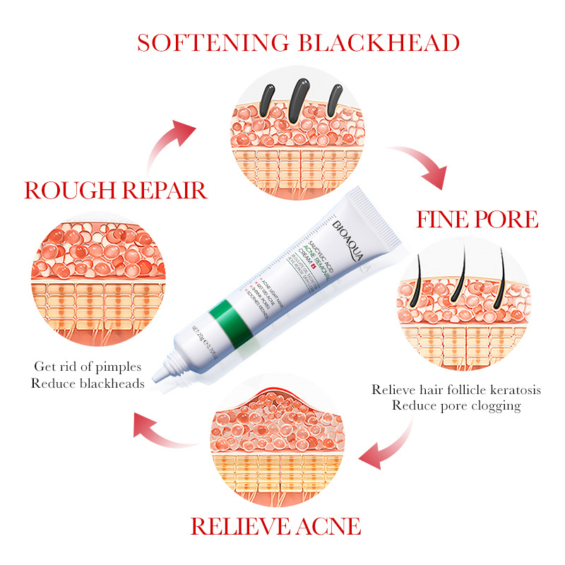 1/2/3pcs BIOAQUA Salicylic Aci - Azelaic Acid Cream บทวิจารณ์และราคา