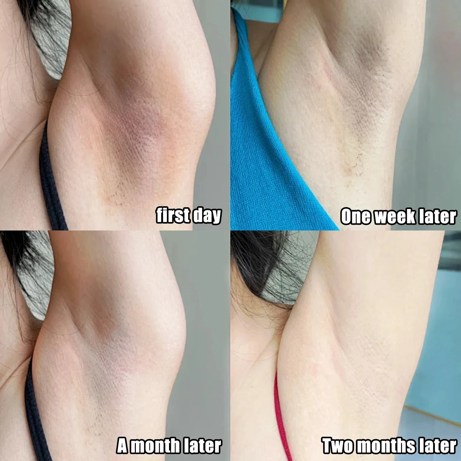 ครีมไวท์เทนนิ่งใต้วงแขนสำหรับผ - Skincare Whitening บทวิจารณ์และราคา
