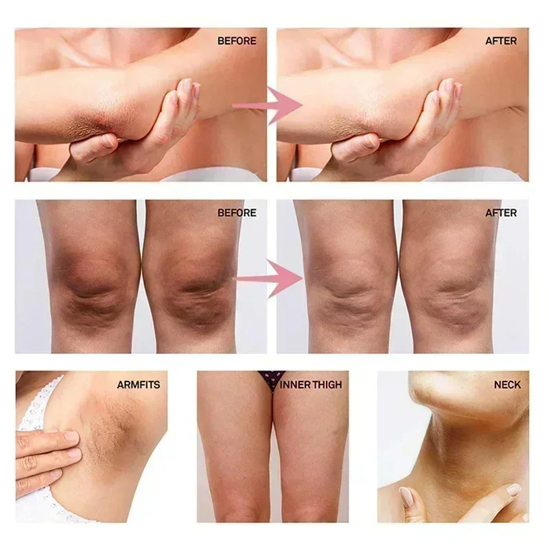 ครีมไวท์เทนนิ่งใต้วงแขนสำหรับผ - Skincare Whitening บทวิจารณ์และราคา