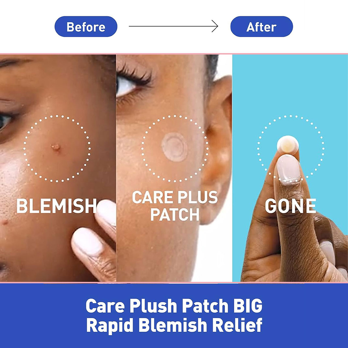 โอลีฟ ยัง แคร์ พลัส สปอต คัฟเว - Skincare Acne บทวิจารณ์และราคา