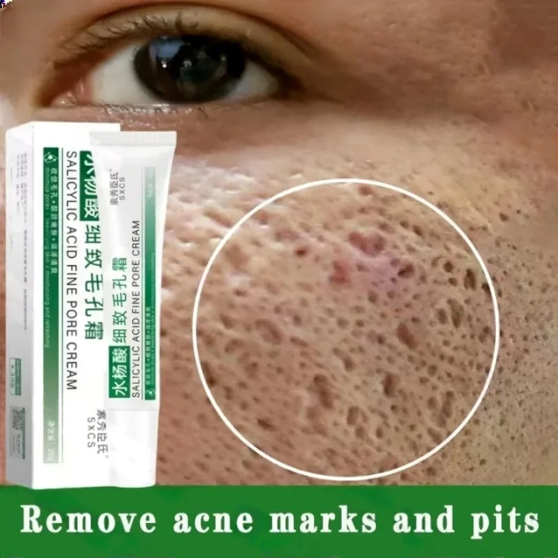Salicylic Acid Pore Clearing C - Azelaic Acid Cream บทวิจารณ์และราคา