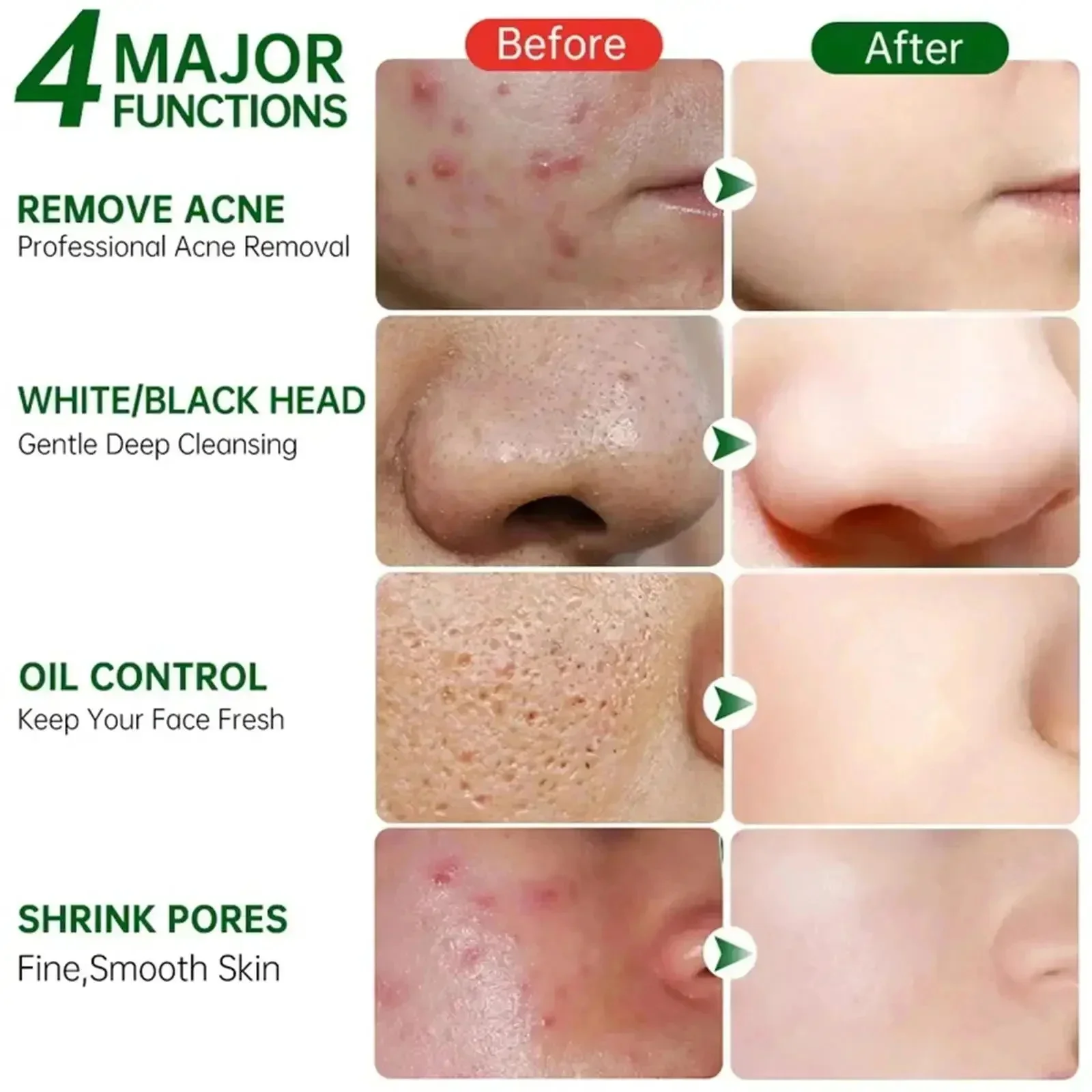 Salicylic Acid Pore Clearing C - Azelaic Acid Cream บทวิจารณ์และราคา