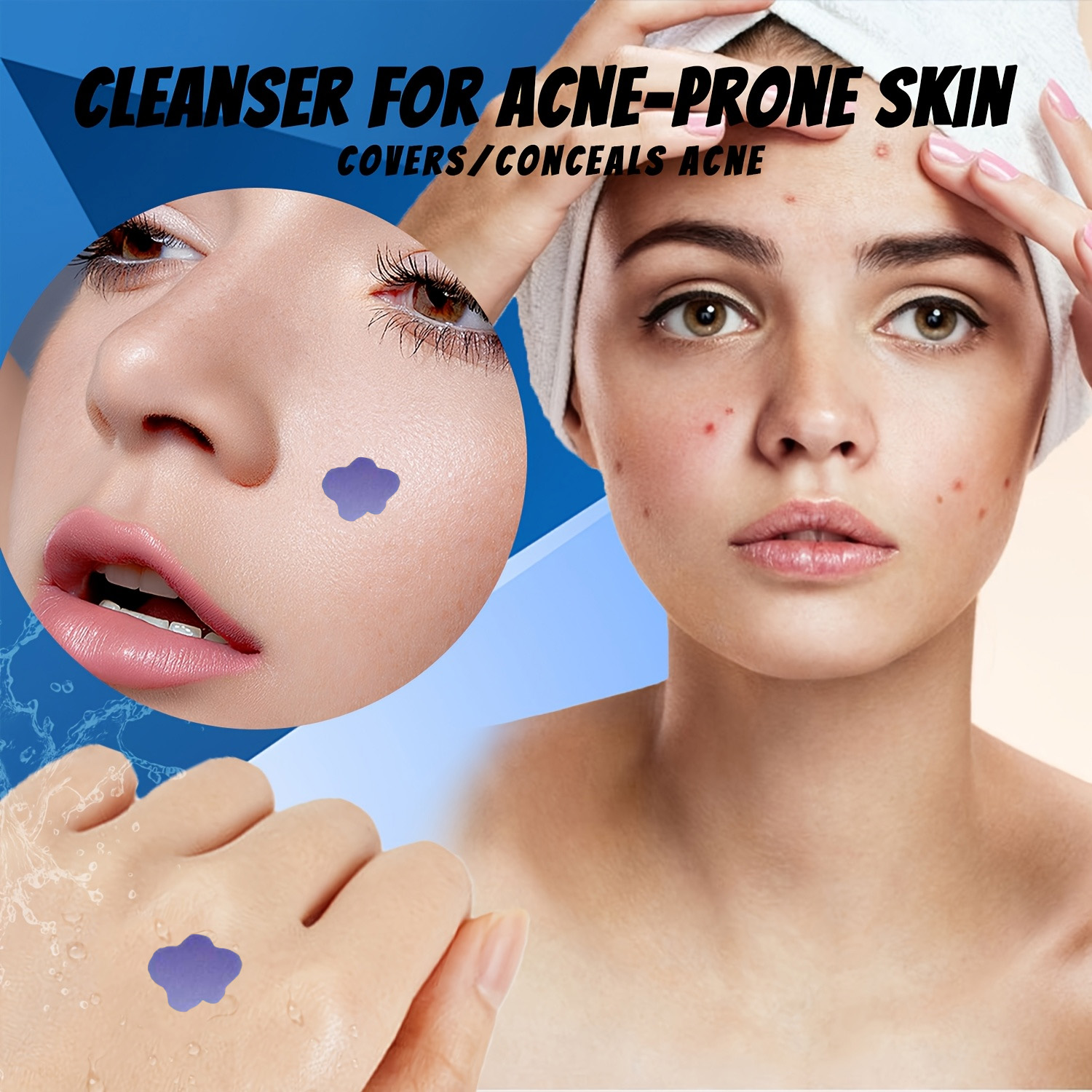แผ่นแปะสิวไมโครนีดเดิล 232 ชิ้ - Skincare Acne บทวิจารณ์และราคา
