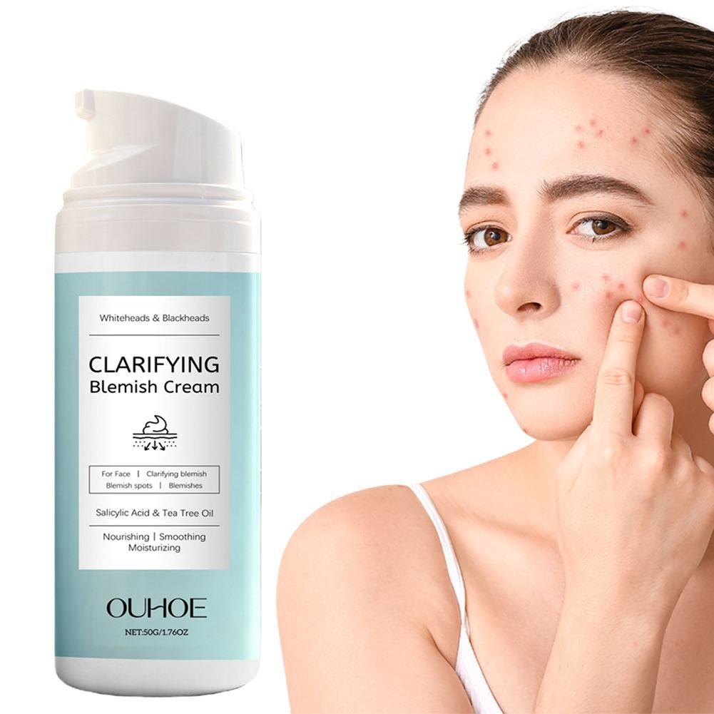 ครีมบำรุงผิวหน้าด้วยกรดซาลิไซล - Azelaic Acid Cream บทวิจารณ์และราคา