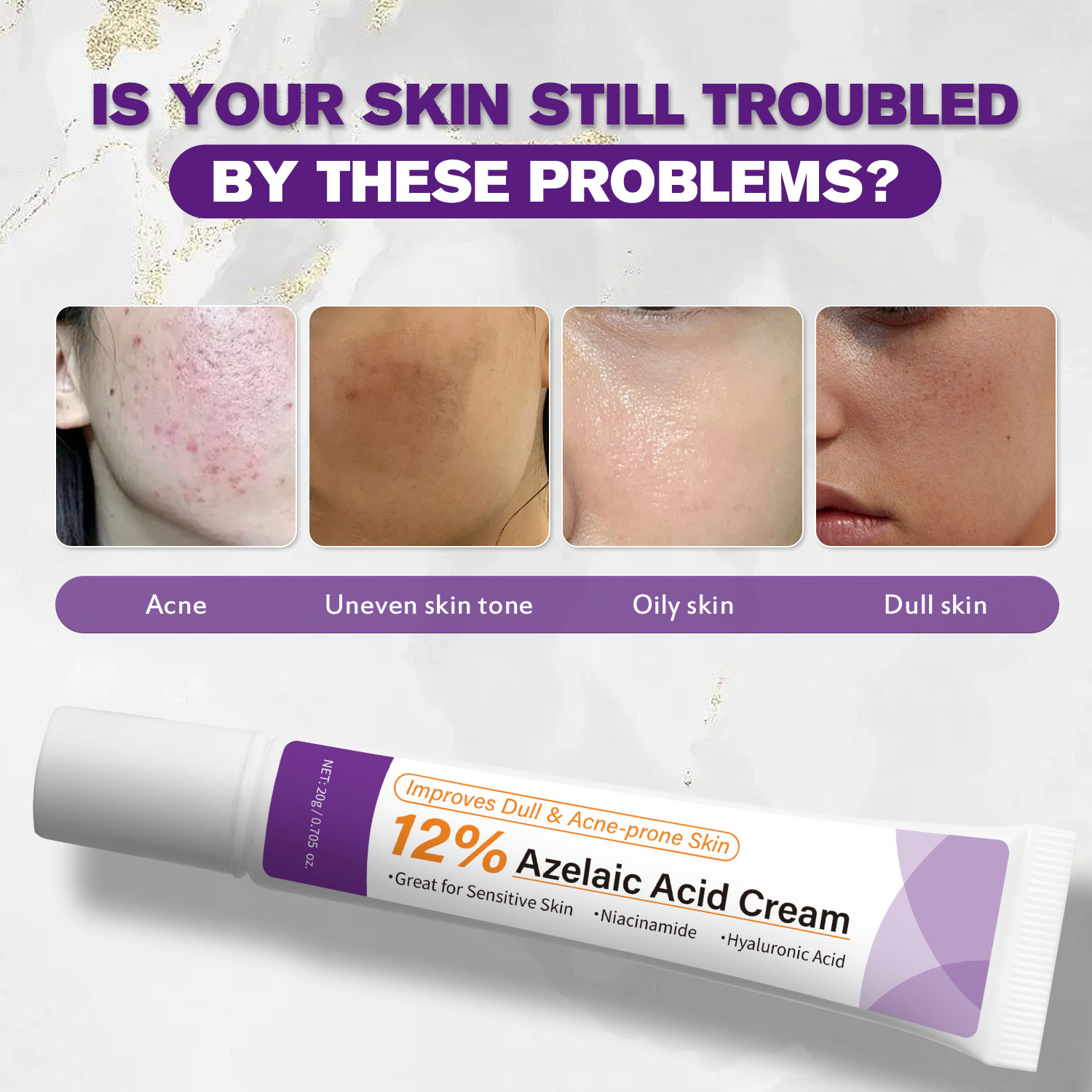 ครีมกรดอะซีเลอิกสูตรอ่อนโยน ช่ - Azelaic Acid Cream บทวิจารณ์และราคา